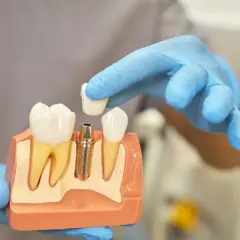 Jak dentysta sprawdza, który ząb boli i co musisz wiedzieć o bólu zębów