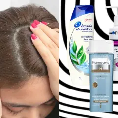 Łupież na głowie i szampony przeciwłupieżowe: Head & Shoulders, Pirolam, Pharmaceris. Co jest dobre na łupież?