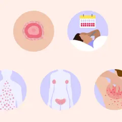 Immagine illustra la pitiriasi rosea di Gibert, con un medaglione iniziale, eruzione cutanea diffusa, e un'icona che suggerisce stress e malessere.
