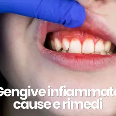 Dente con gengive rosse e gonfie, segno di dolore alle gengive che non passa. Esplorazione con guanto blu.