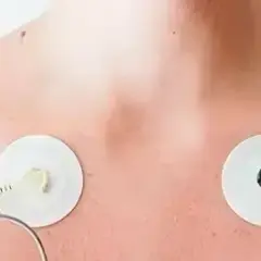 Holter EKG: Czy diagnozuje nerwicę serca? Odpowiedź eksperta