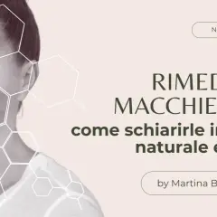 Donna con macchie sul viso, con grafiche esagonali. Titolo: "Rimedi per macchie viso: come coprire le macchie sul viso in modo naturale e sicuro".