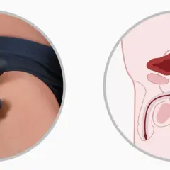 Dłoń trzymająca czarny masażer prostaty obok schematu męskiej anatomii z podświetloną prostatą.