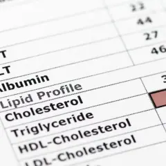 Wynik lipidogramu: podwyższone trójglicerydy (1.5), cholesterol (2.25) i HDL-cholesterol (1.0).