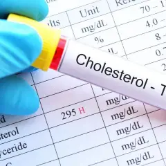Aktualne normy cholesterolu w Polsce: Klucz do zdrowego serca