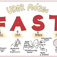 Udar mózgu u dzieci: FAST - twarz, ręka, mowa, czas. Objawy: opadnięty kącik ust, osłabienie siły mięśniowej, nieadekwatne słowa, braki w mowie, brak reakcji na czas.