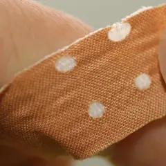Nahaufnahme eines Pflasters auf einer Hautstelle, die eine offene Brandblase zeigt. Das Pflaster schützt die Wunde vor Luft.