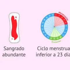 Ilustración de síntomas de la regla: duración >8 días, sangrado abundante, ciclo corto (<23 días) y metrorragia.