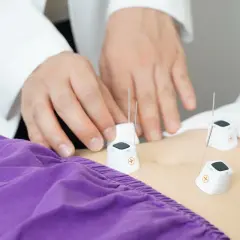 Dłonie terapeuty umieszczają igły do akupunktury na brzuchu pacjenta. Zobacz, co daje akupresura.