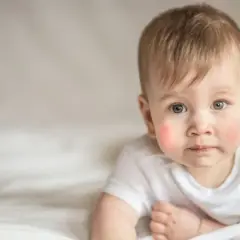 Objawy AZS u niemowlaka - jak rozpoznać atopowe zapalenie skóry