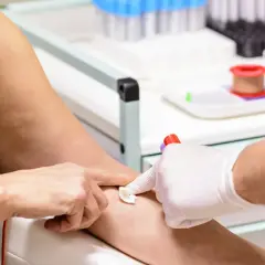 Pobieranie krwi do badań. Ręka pacjentki z widocznymi żyłami, pielęgniarka w białej rękawiczce przygotowuje miejsce wkłucia. W tle probówki i sprzęt medyczny. MPV niskie.