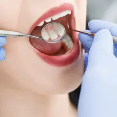 Gdzie do dentysty na NFZ? Znajdź najlepsze oferty w swojej okolicy