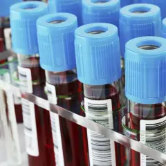 Rząd probówek z krwią, każda z niebieską zakrętką. W tle widać więcej probówek, tworząc laboratoryjny prf.