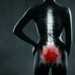 Radiographie du bassin humain, mettant en évidence une zone pelvienne enflammée en rouge.