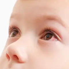 Occhio di neonato con una piccola macchia rossa, forse un segno di stanchezza o irritazione.