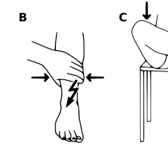 Ilustracje A, B, C pokazują zastosowanie zasady PRICE w leczeniu urazów: P - ochrona, R - odpoczynek, I - lod, C - ucisk, E - elewacja.