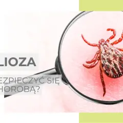 Kleszcze i borelioza: Jak skutecznie zapobiegać i co robić po ukąszeniu?