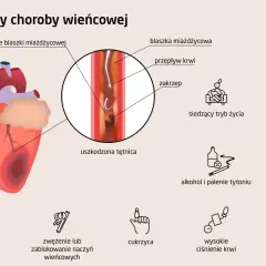 Ilustracja przedstawia serce i czynniki ryzyka choroby wieńcowej: miażdżycę, nadwagę, cukrzycę, wysokie ciśnienie, alkohol, palenie, siedzący tryb życia i predyspozycje genetyczne.