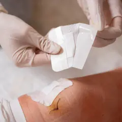 Rękawiczki medyczne przygotowują nowy plaster, by zmienić ten, który wywołał uczulenie od plastra opatrunkowego.