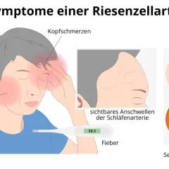 Morbus Horton Diagnostik: Wichtige Kriterien und Symptome erkennen