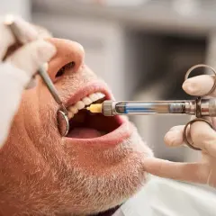 Po jakim czasie schodzi znieczulenie od dentysty? Sprawdź to teraz!