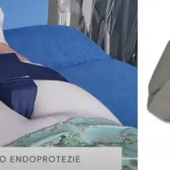 Czy po endoprotezie biodra przysługuje renta? Sprawdź warunki i pomoc