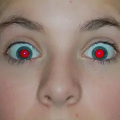 Oczy z czerwonymi źrenicami, jak po nieudanym usuwaniu czerwonych oczu.