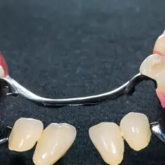 Dwa fragmenty protezy szkieletowej z metalowym stelażem i sztucznymi zębami na różowym podłożu.