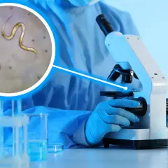 Ile daje się kału do badania? Kluczowe informacje, które musisz znać