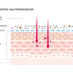 Schädigtes Hautmikrobiom: Bakterien und Schmutz dringen ein. Eine gesunde Hautbarriere ist die Wunderwaffe für ein gesundes Hautmikrobiom.