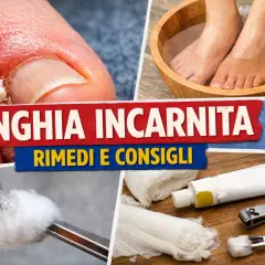 Unghia incarnita: rimedi della nonna e consigli pratici. Pediluvio, medicazioni e strumenti per alleviare il dolore.