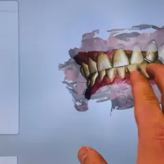 Co dentysta widzi? Więcej niż myślisz - poznaj prawdę