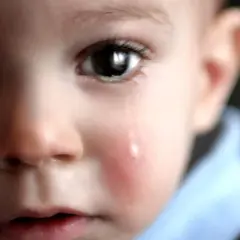 Un bambino piange, una lacrima scende sulla sua guancia arrossata. L'orzaiolo sui suoi occhietti lo fa soffrire.