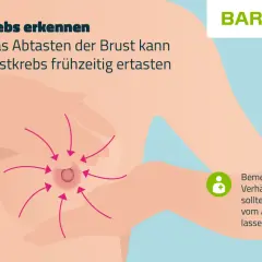 Brustkrebs erkennen: Pfeile zeigen auf eine Brustwarze, wo sich Knoten in der Brust befinden könnten. Bei Verhärtungen Arzt aufsuchen.