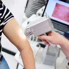 Dermatoskopia co to? Lekarz bada znamiona na ramieniu pacjentki za pomocą dermatoskopu, obraz widoczny na ekranie laptopa.