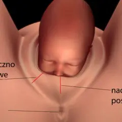 Jak długo boli nacięcie krocza po porodzie? Czas gojenia i ból.