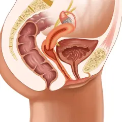 Anatomie pelvienne féminine montrant le côlon, la vessie, l'utérus et le sacrum. Illustration pour une opération prolapsus avis.