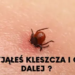 Jak sprawdzić, czy kleszcz wyszedł cały? Praktyczny poradnik