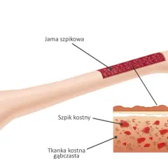 Przekrój kości długiej ukazujący jamę szpikową i tkankę gąbczastą. Szczegółowy widok szpiku kostnego. Budowa kości.