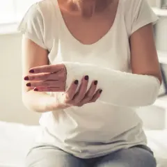 Kobieta z ręką w gipsie na złamania. Biały opatrunek obejmuje przedramię i dłoń, zapewniając stabilizację po urazie.