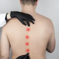 Medico esamina la schiena di un paziente, evidenziando con punti rossi aree di dolore legate all'ipercifosi dorsale.