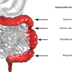 Zespół jelita drażliwego objawy – co powinieneś wiedzieć z forum