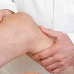Arzt untersucht Knie. Mögliche Symptome für ein Ewing-Sarkom werden abgetastet.
