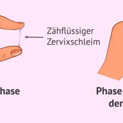 Hände zeigen Zervixschleim: zähflüssig in der Ovulationsphase, klumpig vor und nach dem Eisprung. Ein wichtiges Zeichen für Eisprung Symptome.
