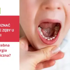 Dziecko z otwartymi ustami, widoczne nieprawidłowe wyrzynanie się zębów stałych. Tekst informuje o zatrzymanych zębach u dzieci i chirurgii stomatologicznej.