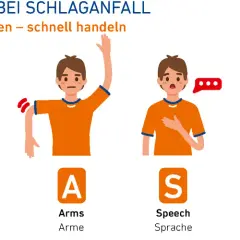 Apoplexie Symptome: Erkennen Sie die alarmierenden Anzeichen sofort