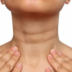 Cuello con acantosis nigricans, mostrando la hiperpigmentación y textura irregular. Se exploran opciones de tratamiento.