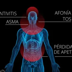 Ilustración de un cuerpo humano con zonas rojas indicando síntomas como conjuntivitis, asma, afonía, tos y pérdida de apetito, posiblemente por polen flor.