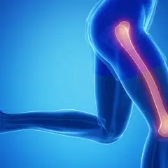 Anatomia nogi z podświetloną kością udową, sugerującą złamanie kości udowej.