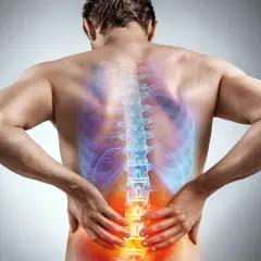 Ból pleców, który może być objawem **sciatica po polsku**. Widoczny kręgosłup z zaznaczonymi obszarami bólu.